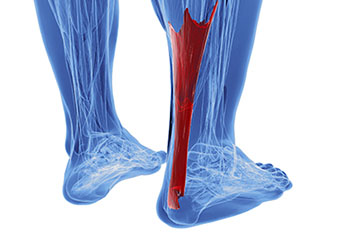 achilles tendon treatment in the Nevada County, CA: Grass Valley (Union Hill, Truckee, Peardale, Willow Valley, La Barr Meadows, Alta Sierra, Nevada City), as well as Placer County, CA: Roseville, Lincoln, Auburn, and Sutter County, CA: Yuba City, Live Oak areas